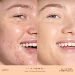A person's face before and after applying SunnyDays™ Tinted SPF 30 in the shade 13 La Cienega, revealing sheer, buildable coverage that visibly evens skin tone and softens discoloration while maintaining a natural, skin-like finish. [13 La Cienega]