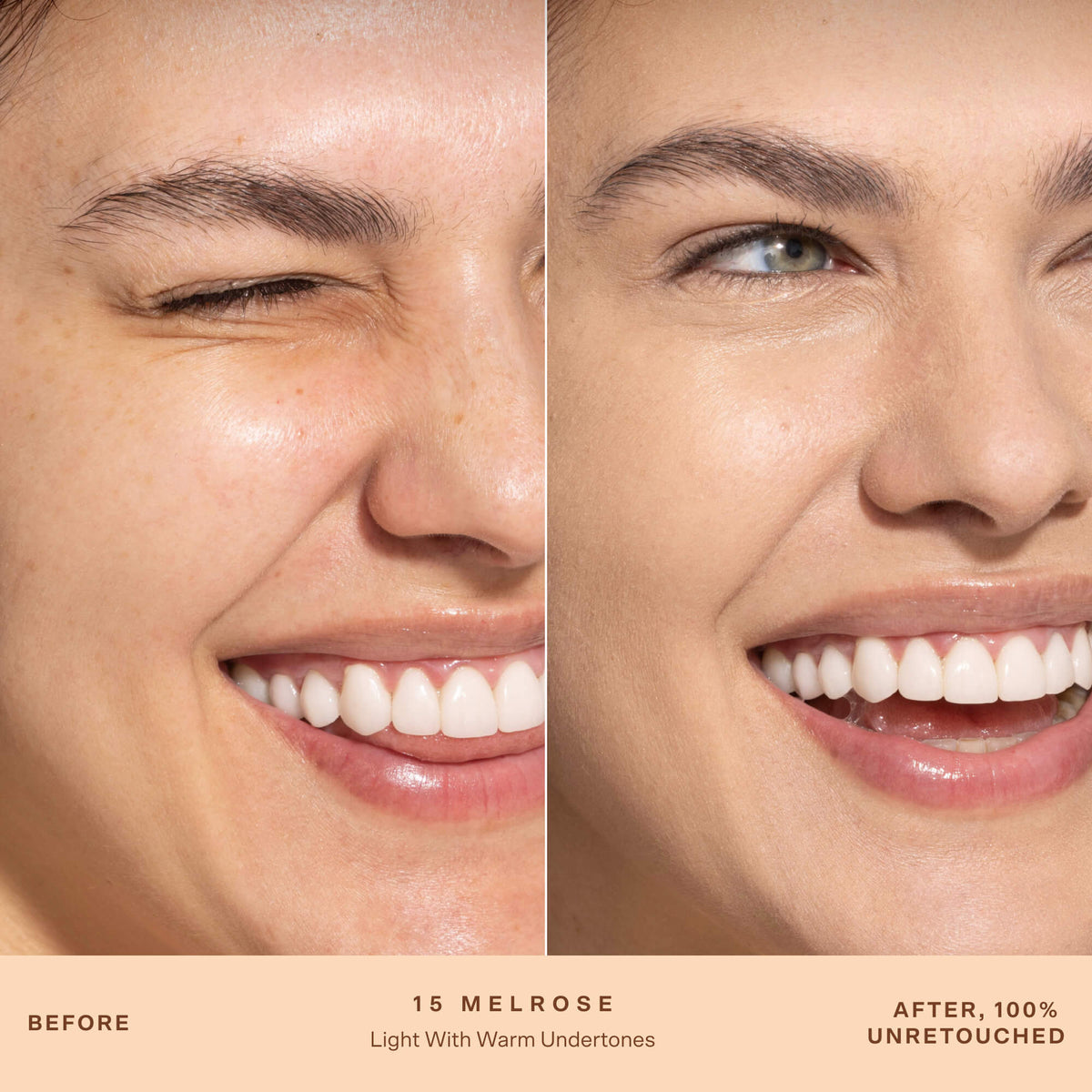 A person's face before and after applying SunnyDays™ Tinted SPF 30 in the shade 15 Melrose, revealing sheer, buildable coverage that visibly evens skin tone and softens discoloration while maintaining a natural, skin-like finish. [15 Melrose]